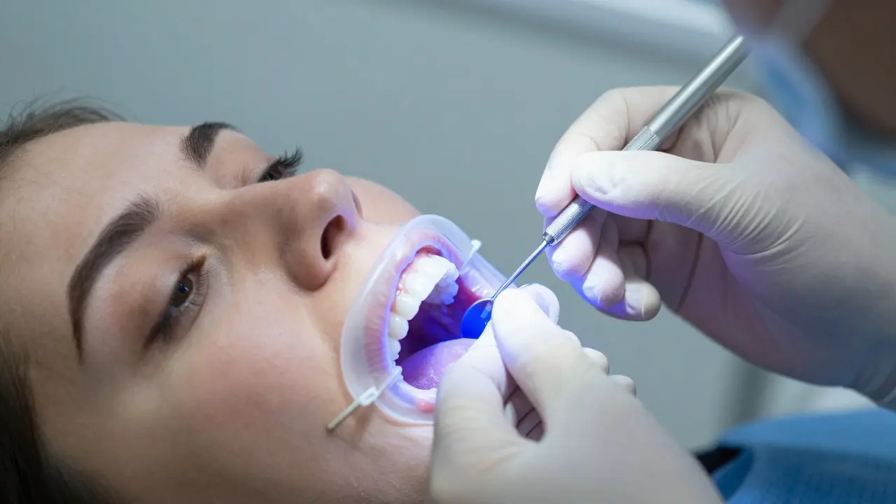 Jak funguje bělení zubů: Kompletní průvodce pro bezpečný a trvalý výsledek