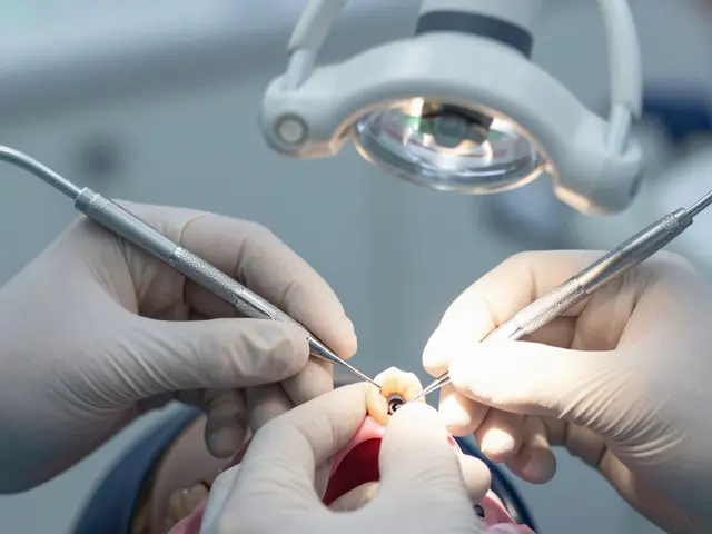 Co je lepší: implantát nebo můstek? Praktické srovnání pro rozhodnutí