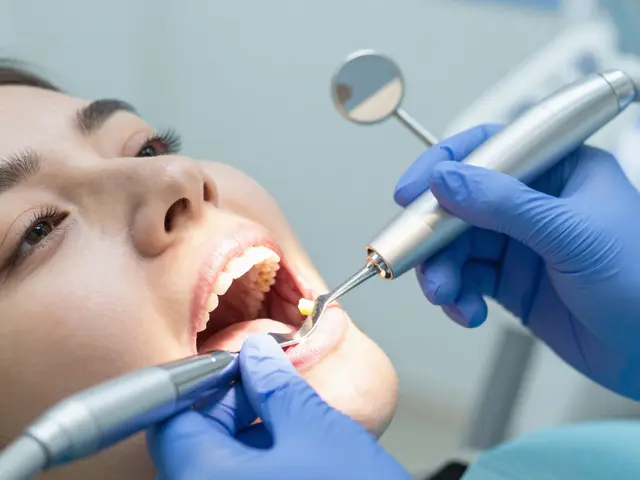 5 hlavních důvodů, proč byste měli zvážit kyretáž zubů