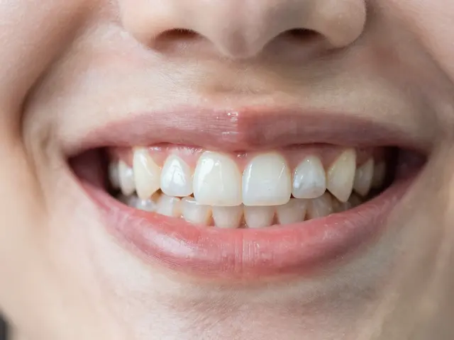 Zničené zuby po rovnátkách: Jak vyřešit kazy, erozi a problémy s dásněmi