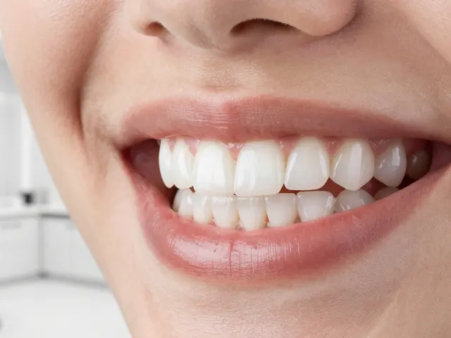 Co znamená s fazetou? Vše o zubních porcelánových obloženích