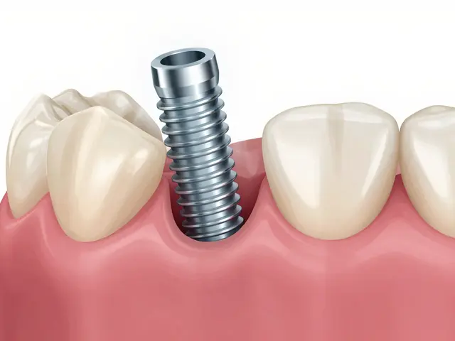 Jak se projevuje kapsule u zubního implantátu? Příznaky a řešení